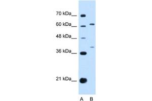 Western Blotting (WB) image for anti-Interleukin 28 Receptor, alpha (Interferon, lambda Receptor) (IL28RA) antibody (ABIN2463129) (IL28RA antibody)