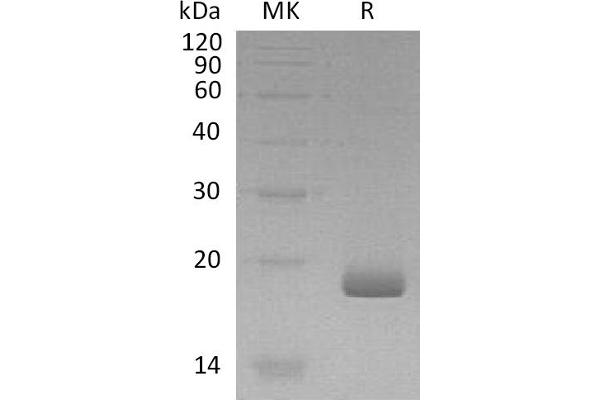 IL28B Protein