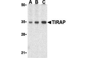Western Blotting (WB) image for anti-Toll-Interleukin 1 Receptor (TIR) Domain Containing Adaptor Protein (TIRAP) (C-Term) antibody (ABIN1030739) (TIRAP antibody  (C-Term))