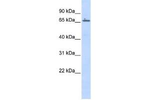 Human Placenta; WB Suggested Anti-ZNF503 Antibody Titration: 0.