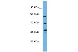 FMO3 antibody used at 1 ug/ml to detect target protein. (FMO3 antibody  (N-Term))