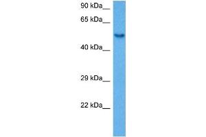 Host:  Rabbit  Target Name:  SP1  Sample Tissue:  Mouse Spleen  Antibody Dilution:  1ug/ml (SP1 antibody  (Middle Region))