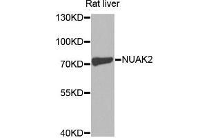 Western blot analysis of extracts of rat liver, using NUAK2 antibody (ABIN1873980) at 1:1000 dilution.