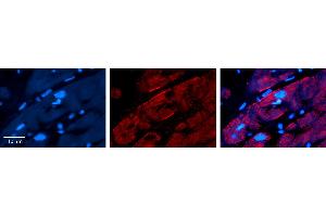 Rabbit Anti-CAP1 Antibody   Formalin Fixed Paraffin Embedded Tissue: Human heart Tissue Observed Staining: Plasma membrane Primary Antibody Concentration: N/A Other Working Concentrations: 1:600 Secondary Antibody: Donkey anti-Rabbit-Cy3 Secondary Antibody Concentration: 1:200 Magnification: 20X Exposure Time: 0. (CAP1 antibody  (Middle Region))