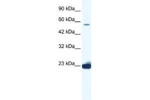 WB Suggested Anti-DDX55 Antibody Titration:  1. (DDX55 antibody  (C-Term))