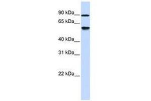 Image no. 1 for anti-Alcohol Dehydrogenase, Iron Containing, 1 (ADHFE1) (AA 288-337) antibody (ABIN6741163) (ADHFE1 antibody  (AA 288-337))