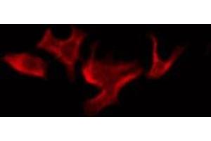 ABIN6276088 staining COLO205 by IF/ICC. (OR52B2 antibody  (Internal Region))