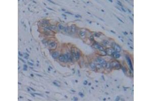 Figure. (ALPPL2 antibody  (AA 20-333))