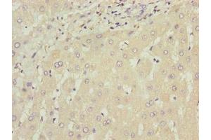 Immunohistochemistry of paraffin-embedded human liver tissue using ABIN7175794 at dilution of 1:100 (WDR74 antibody  (AA 111-366))