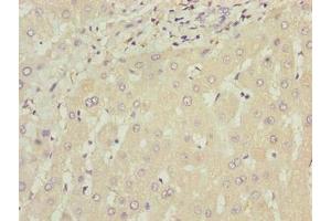Immunohistochemistry of paraffin-embedded human liver tissue using ABIN7175794 at dilution of 1:100 (WDR74 antibody  (AA 111-366))