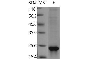 Western Blotting (WB) image for Sonic Hedgehog (SHH) (Active) protein (His tag) (ABIN7198797) (Sonic Hedgehog Protein (SHH) (His tag))