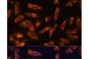 Immunofluorescence analysis of U-2 OS cells using CSF2 Polyclonal Antibody at dilution of 1:100. (GM-CSF antibody)
