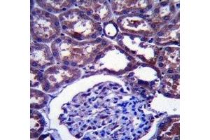 NPC1 antibody immunohistochemistry analysis in formalin fixed and paraffin embedded human kidney tissue. (NPC1 antibody  (AA 591-620))