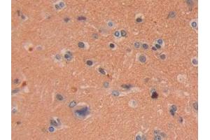 Detection of DDAH2 in Human Brain Tissue using Polyclonal Antibody to Dimethylarginine Dimethylaminohydrolase 2 (DDAH2) (DDAH2 antibody  (AA 31-265))