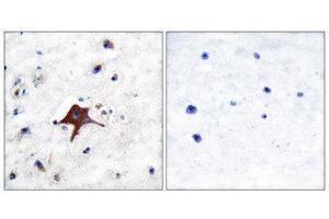 Immunohistochemistry (IHC) image for anti-Solute Carrier Family 2 (Facilitated Glucose Transporter), Member 3 (SLC2A3) (C-Term) antibody (ABIN1848584) (SLC2A3 antibody  (C-Term))