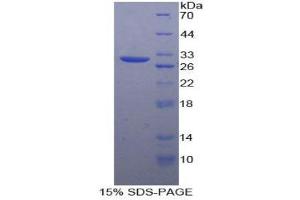 SDS-PAGE (SDS) image for Gap Junction Protein, alpha 4, 37kDa (GJA4) (AA 79-328) protein (His tag) (ABIN2120893)