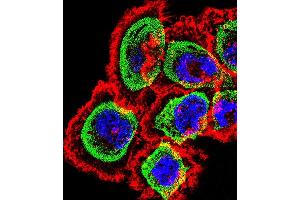 Fluorescent confocal image of A431 cell stained with RCAN1 Antibody (N-term) (ABIN1539360 and ABIN2848483). (RCAN1 antibody  (N-Term))