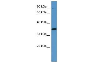 Western Blotting (WB) image for anti-Mitogen-Activated Protein Kinase-Activated Protein Kinase 3 (MAPKAPK3) (C-Term) antibody (ABIN2788403) (MAPKAP Kinase 3 antibody  (C-Term))