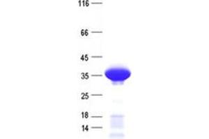 Chromosome 3 Open Reading Frame 62 (C3orf62) protein (His tag)