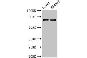 Western Blot Positive WB detected in: Mouse liver tissue, Mouse kidney tissue All lanes: SLC22A23 antibody at 5.