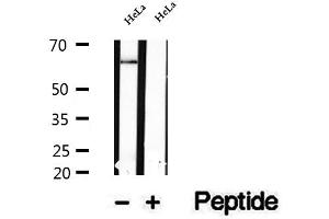 Western blot analysis of extracts of HeLa cells, using NFKBIZ antibody. (NFKBIZ antibody  (Internal Region))