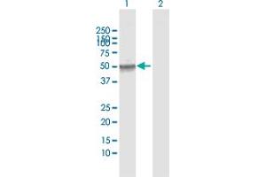 Western Blot analysis of ECGF1 expression in transfected 293T cell line by ECGF1 MaxPab polyclonal antibody. (Thymidine Phosphorylase antibody  (AA 1-482))