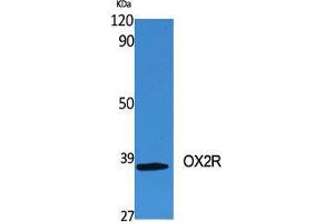 Western Blot (WB) analysis of specific cells using OX2R Polyclonal Antibody. (HCRTR2 antibody  (C-Term))