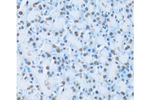 Immunohistochemistry of paraffin-embedded Rat pancreas using HNF4A Polyclonal Antibody at dilution of 1:100 (40x lens). (HNF4A antibody)