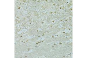 Immunohistochemistry of paraffin-embedded mouse brain using RCC1 antibody (ABIN5973761) at dilution of 1/100 (40x lens). (RCC1 antibody)
