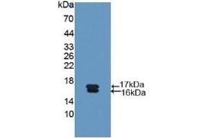 Detection of Recombinant Glycocalicin, Human using Polyclonal Antibody to Glycocalicin (GC) (Glycocalicin antibody  (AA 136-276))