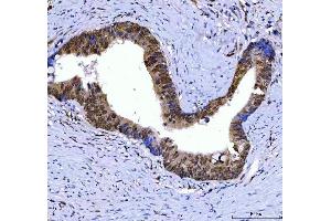 IHC analysis of SSRP1 using anti-SSRP1 antibody (ABIN7600496). (SSRP1 antibody  (AA 2-381))