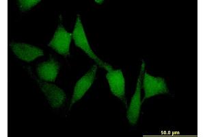 Immunofluorescence of monoclonal antibody to SMAD7 on HeLa cell. (SMAD7 antibody  (AA 302-400))