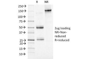 SDS-PAGE Analysis Purified Adipophilin Mouse Monoclonal Antibody (ADFP/1493). (ADRP antibody  (AA 249-376))