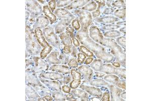 Immunohistochemistry of paraffin-embedded mouse kidney using DC Rabbit mAb (ABIN7266685) at dilution of 1:200 (40x lens). (DCAF7 antibody)