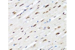 Immunohistochemistry of paraffin-embedded Rat heart using HNRNPR Polyclonal Antibody at dilution of 1:100 (40x lens). (HNRNPR antibody)