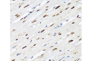 Immunohistochemistry of paraffin-embedded Rat heart using HNRNPR Polyclonal Antibody at dilution of 1:100 (40x lens). (HNRNPR antibody)