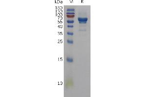 SDS-PAGE (SDS) image for Amphiregulin (AREG) (AA 20-187) protein (Fc Tag) (ABIN7491191)