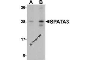 Western Blotting (WB) image for anti-Spermatogenesis Associated 3 (SPATA3) (C-Term) antibody (ABIN1077366) (SPATA3 antibody  (C-Term))