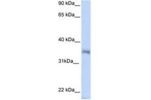 Image no. 1 for anti-Hexamthylene Bis-Acetamide Inducible 2 (HEXIM2) (N-Term) antibody (ABIN6743044)