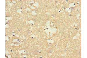 Immunohistochemistry of paraffin-embedded human brain tissue using ABIN7161350 at dilution of 1:100 (CHRNA9 antibody  (AA 26-240))