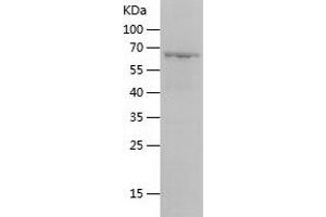 Western Blotting (WB) image for Transcription Factor B2, Mitochondrial (TFB2M) (AA 20-396) protein (His-IF2DI Tag) (ABIN7125446) (TFB2M Protein (AA 20-396) (His-IF2DI Tag))