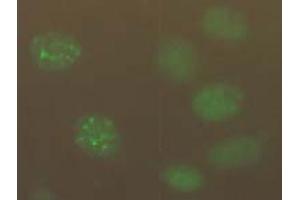Immunofluorescence (IF) image for anti-Chromatin Assembly Factor 1, Subunit B (p60) (CHAF1B) antibody (ABIN1105633) (CHAF1B antibody)