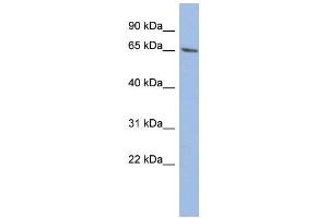 WB Suggested Anti-WT1 Antibody Titration:  0. (WT1 antibody  (Middle Region))