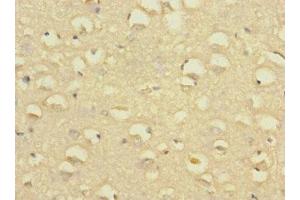 Immunohistochemistry of paraffin-embedded human brain tissue using ABIN7170057 at dilution of 1:100 (SLC24A1 antibody  (AA 330-452))