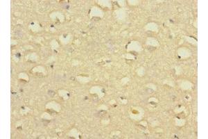 Immunohistochemistry of paraffin-embedded human brain tissue using ABIN7170057 at dilution of 1:100