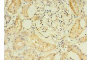 Immunohistochemistry of paraffin-embedded human kidney tissue using ABIN7175049 at dilution of 1:100 (C2ORF69 antibody  (AA 117-269))