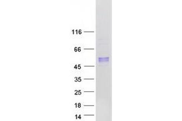 Arylsulfatase B Protein (ARSB) (Transcript Variant 2) (Myc-DYKDDDDK Tag)