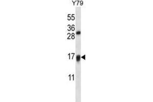 Western Blotting (WB) image for anti-Vitamin K Epoxide Reductase Complex, Subunit 1-Like 1 (VKORC1L1) antibody (ABIN2997461) (VKORC1L1 antibody)