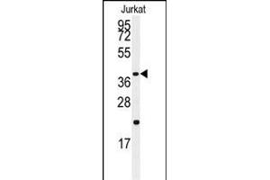 Western blot analysis of anti-CASP9 Antibody  (ABIN1881137 and ABIN2842071) in Jurkat cell line lysates (35 μg/lane).