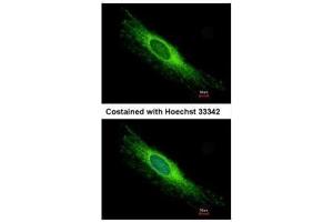ICC/IF Image Immunofluorescence analysis of methanol-fixed HeLa, using PEX26, antibody at 1:500 dilution. (PEX26 antibody)